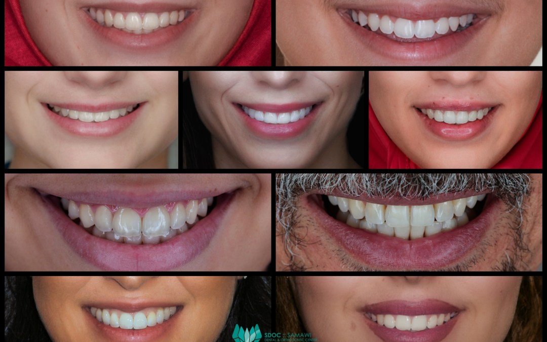 A Guide for Parents and Referring Dentists on Orthodontic Care