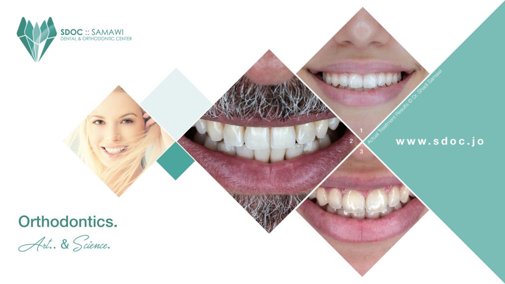 A collage showcasing diverse smiles: a close-up of a smiling woman's face, an older man's mouth with a close-up of his teeth, a younger woman's smile, and a child's smile, all emphasizing orthodontic treatment results.