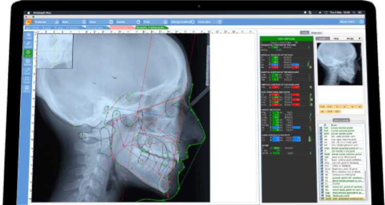 Samawi Dental & Orthodontic Center :: SDOC :: Digital Radiography