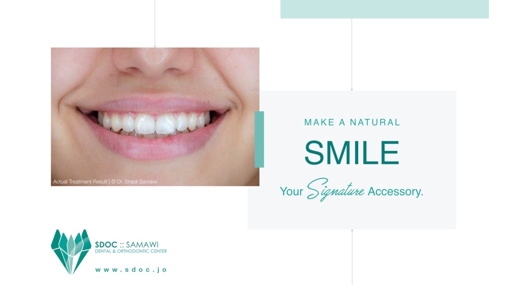 Close-up of a smiling person showing straight teeth, with the text 'Make a Natural Smile Your Signature Accessory' and annotation about treatment results.